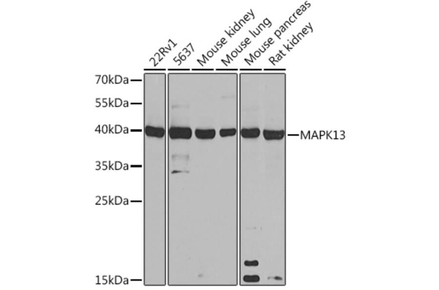 Western Blot - Anti-p38 delta/MAPK13 Antibody (A305398) - Antibodies.com
