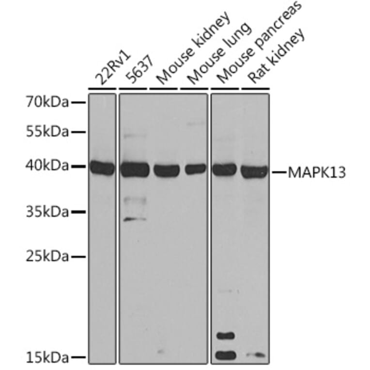 Western Blot - Anti-p38 delta/MAPK13 Antibody (A305398) - Antibodies.com