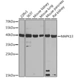 Western Blot - Anti-p38 delta/MAPK13 Antibody (A305398) - Antibodies.com