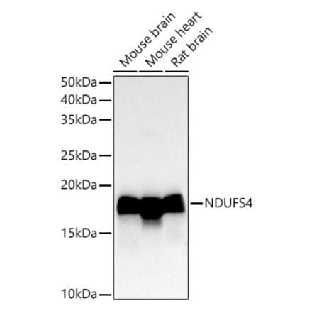 Western Blot - Anti-Ndufs4 Antibody [ARC54574] (A305399) - Antibodies.com