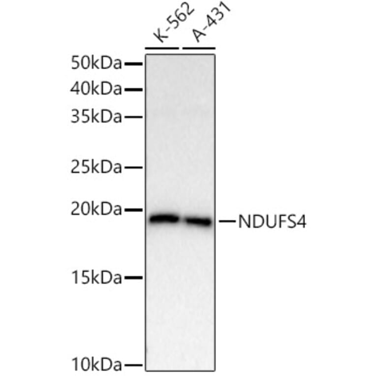 Western Blot - Anti-Ndufs4 Antibody [ARC54574] (A305399) - Antibodies.com