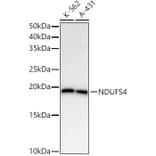 Western Blot - Anti-Ndufs4 Antibody [ARC54574] (A305399) - Antibodies.com