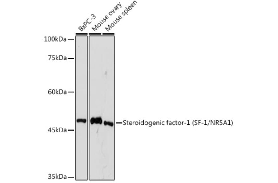 Western Blot - Anti-Steroidogenic Factor 1/SF-1 Antibody [ARC2457] (A305400) - Antibodies.com