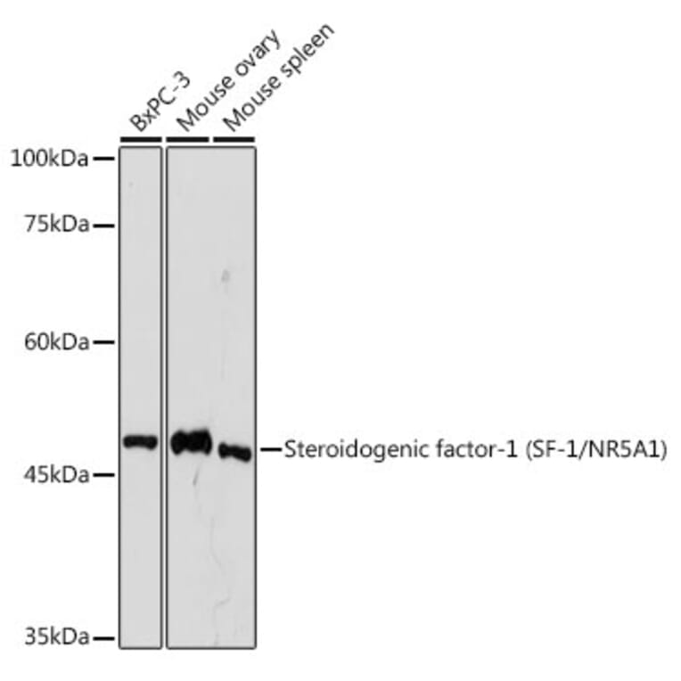 Western Blot - Anti-Steroidogenic Factor 1/SF-1 Antibody [ARC2457] (A305400) - Antibodies.com
