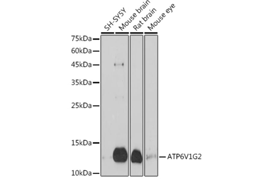 Western Blot - Anti-ATP6V1G2 Antibody (A305403) - Antibodies.com