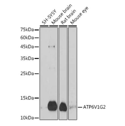 Western Blot - Anti-ATP6V1G2 Antibody (A305403) - Antibodies.com