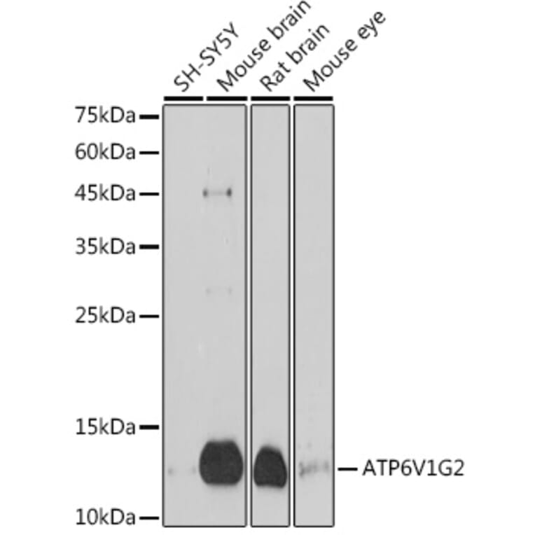 Western Blot - Anti-ATP6V1G2 Antibody (A305403) - Antibodies.com