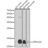 Western Blot - Anti-ATP6V1G2 Antibody (A305403) - Antibodies.com