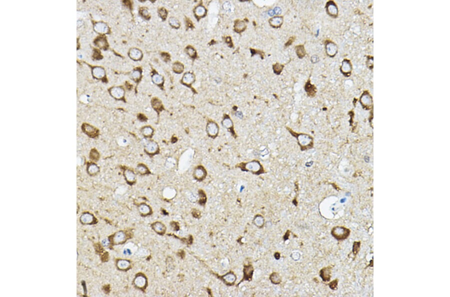 Immunohistochemistry - Anti-ATP6V1G2 Antibody (A305403) - Antibodies.com