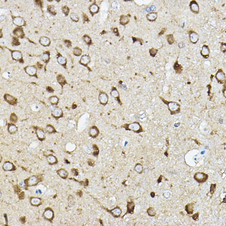 Immunohistochemistry - Anti-ATP6V1G2 Antibody (A305403) - Antibodies.com