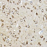 Immunohistochemistry - Anti-ATP6V1G2 Antibody (A305403) - Antibodies.com