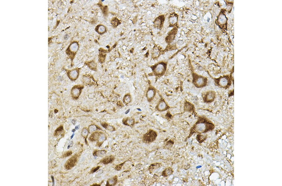 Immunohistochemistry - Anti-ATP6V1G2 Antibody (A305403) - Antibodies.com
