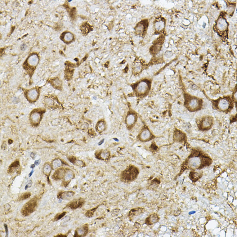 Immunohistochemistry - Anti-ATP6V1G2 Antibody (A305403) - Antibodies.com