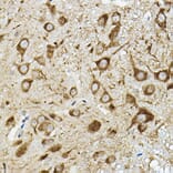 Immunohistochemistry - Anti-ATP6V1G2 Antibody (A305403) - Antibodies.com