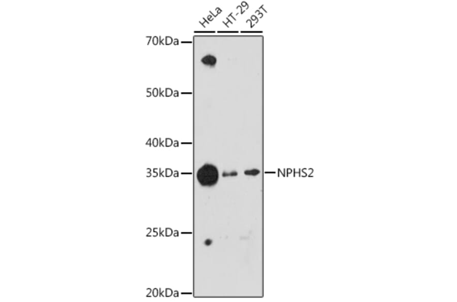 Western Blot - Anti-NPHS2 Antibody [ARC1907] (A305404) - Antibodies.com