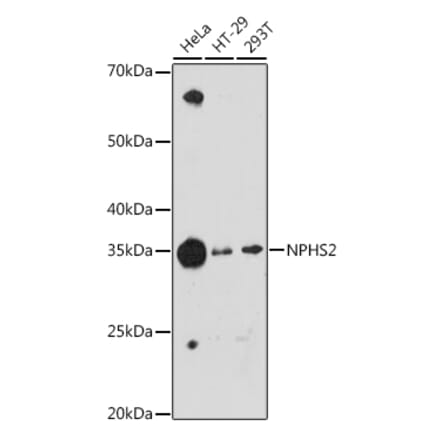 Western Blot - Anti-NPHS2 Antibody [ARC1907] (A305404) - Antibodies.com