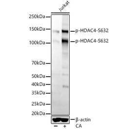 Western Blot - Anti-HDAC4 (phospho Ser632) Antibody [ARC56258] (A305405) - Antibodies.com