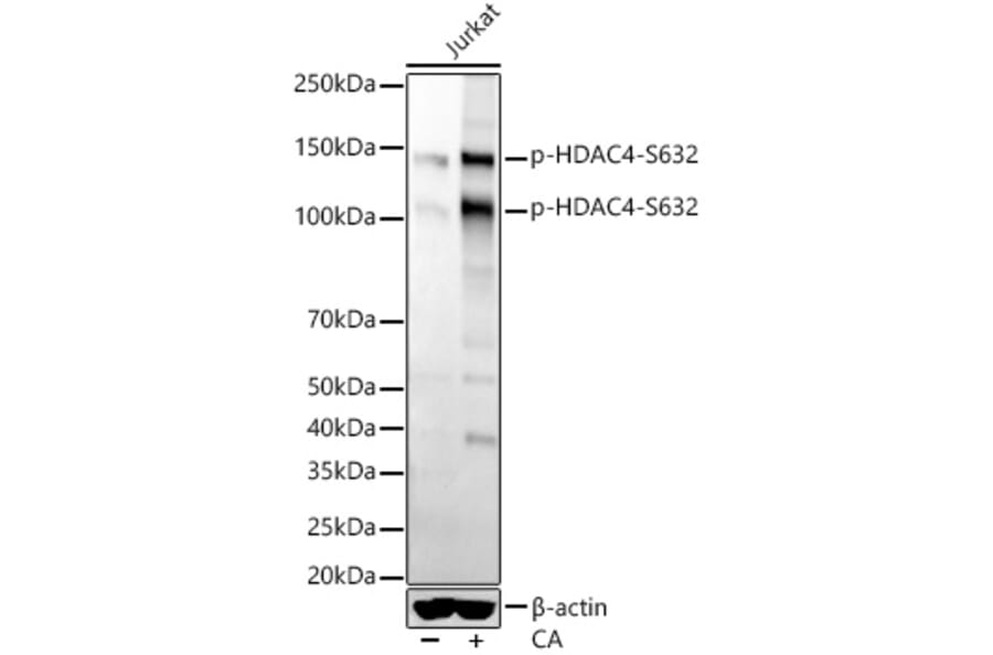 Western Blot - Anti-HDAC4 (phospho Ser632) Antibody [ARC56258] (A305405) - Antibodies.com