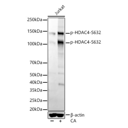 Western Blot - Anti-HDAC4 (phospho Ser632) Antibody [ARC56258] (A305405) - Antibodies.com