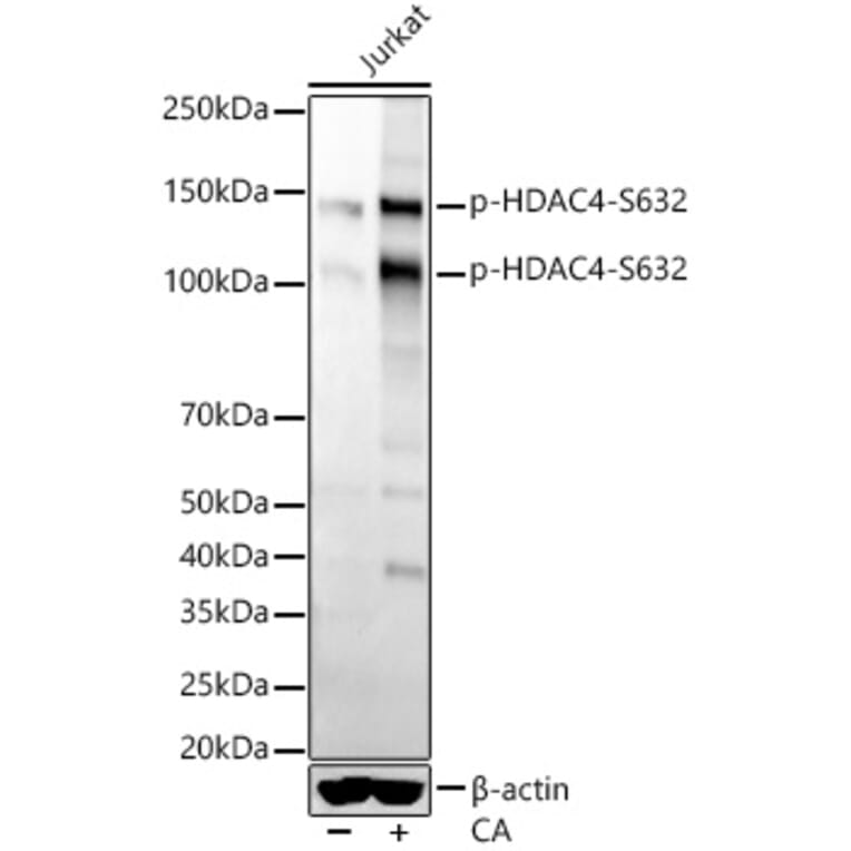 Western Blot - Anti-HDAC4 (phospho Ser632) Antibody [ARC56258] (A305405) - Antibodies.com