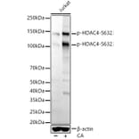 Western Blot - Anti-HDAC4 (phospho Ser632) Antibody [ARC56258] (A305405) - Antibodies.com