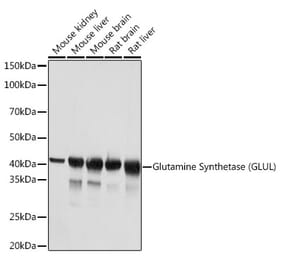 Western Blot - Anti-Glutamine Synthetase Antibody [ARC0120] (A305406) - Antibodies.com