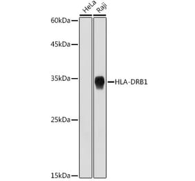 Western Blot - Anti-HLA Class II DRB1 Antibody [ARC2360] (A305407) - Antibodies.com