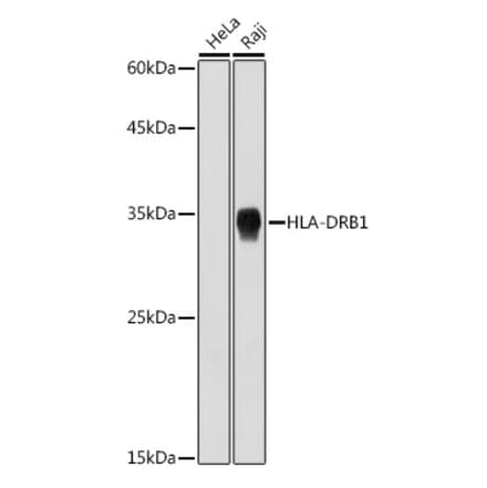 Western Blot - Anti-HLA Class II DRB1 Antibody [ARC2360] (A305407) - Antibodies.com