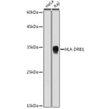 Western Blot - Anti-HLA Class II DRB1 Antibody [ARC2360] (A305407) - Antibodies.com