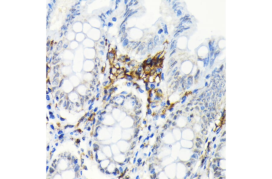 Immunohistochemistry - Anti-HLA Class II DRB1 Antibody [ARC2360] (A305407) - Antibodies.com