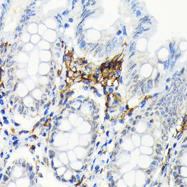 Immunohistochemistry - Anti-HLA Class II DRB1 Antibody [ARC2360] (A305407) - Antibodies.com