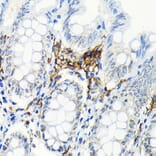 Immunohistochemistry - Anti-HLA Class II DRB1 Antibody [ARC2360] (A305407) - Antibodies.com