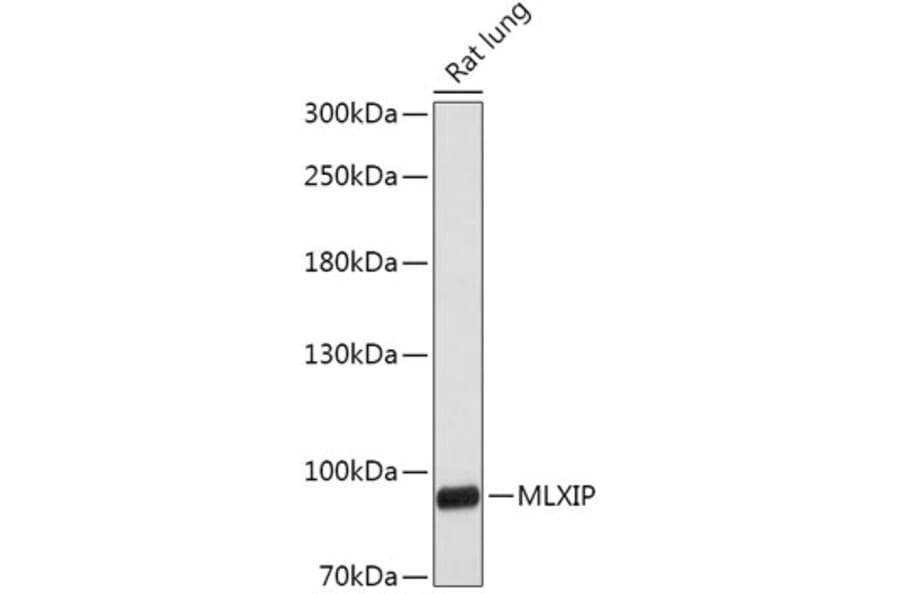 Western Blot - Anti-MLX-interacting protein Antibody (A305408) - Antibodies.com