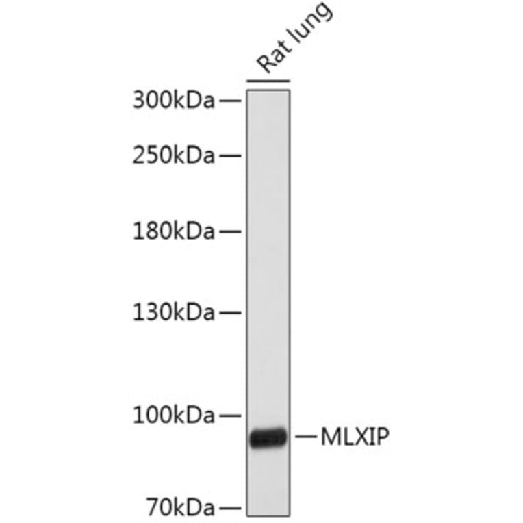 Western Blot - Anti-MLX-interacting protein Antibody (A305408) - Antibodies.com