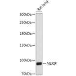 Western Blot - Anti-MLX-interacting protein Antibody (A305408) - Antibodies.com