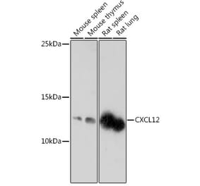 Western Blot - Anti-SDF1 Antibody (A305409) - Antibodies.com