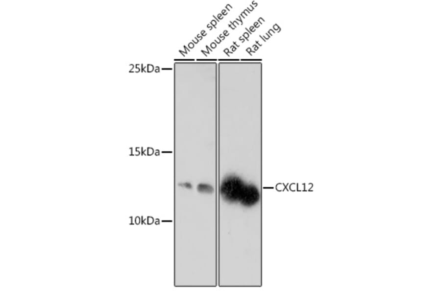 Western Blot - Anti-SDF1 Antibody (A305409) - Antibodies.com