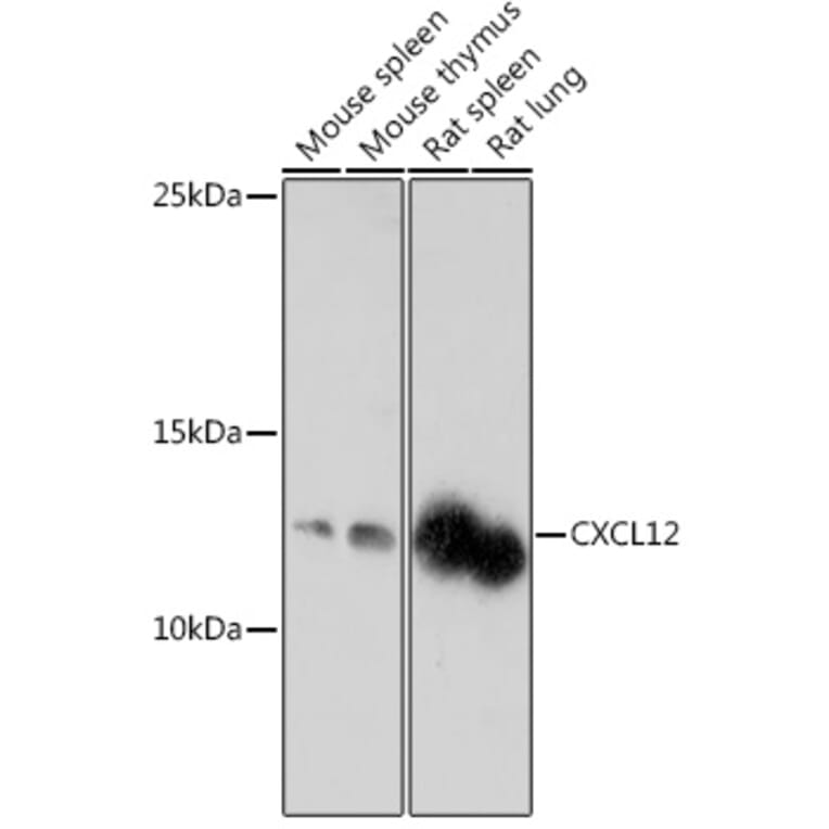 Western Blot - Anti-SDF1 Antibody (A305409) - Antibodies.com