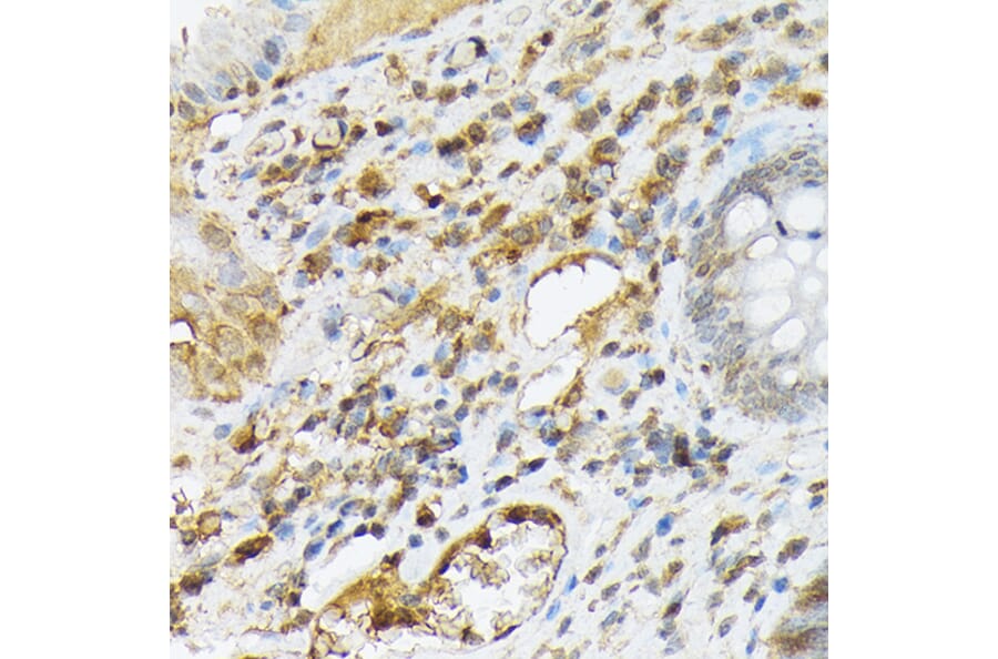 Immunohistochemistry - Anti-SDF1 Antibody (A305409) - Antibodies.com