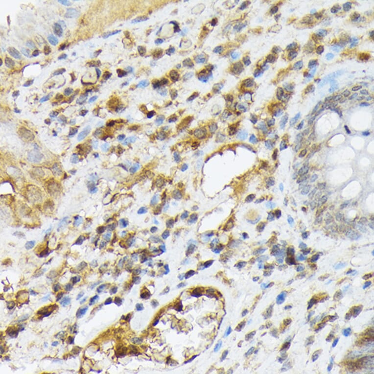 Immunohistochemistry - Anti-SDF1 Antibody (A305409) - Antibodies.com