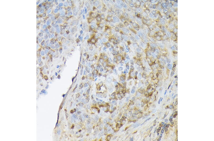 Immunohistochemistry - Anti-SDF1 Antibody (A305409) - Antibodies.com