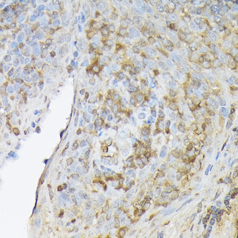 Immunohistochemistry - Anti-SDF1 Antibody (A305409) - Antibodies.com