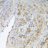 Immunohistochemistry - Anti-SDF1 Antibody (A305409) - Antibodies.com