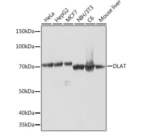 Western Blot - Anti-Pyruvate Dehydrogenase E2 Antibody [ARC1314] (A305411) - Antibodies.com