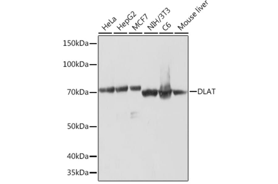Western Blot - Anti-Pyruvate Dehydrogenase E2 Antibody [ARC1314] (A305411) - Antibodies.com