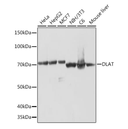 Western Blot - Anti-Pyruvate Dehydrogenase E2 Antibody [ARC1314] (A305411) - Antibodies.com