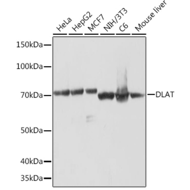 Western Blot - Anti-Pyruvate Dehydrogenase E2 Antibody [ARC1314] (A305411) - Antibodies.com