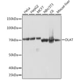 Western Blot - Anti-Pyruvate Dehydrogenase E2 Antibody [ARC1314] (A305411) - Antibodies.com