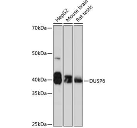 Western Blot - Anti-DUSP6 Antibody [ARC0237] (A305412) - Antibodies.com