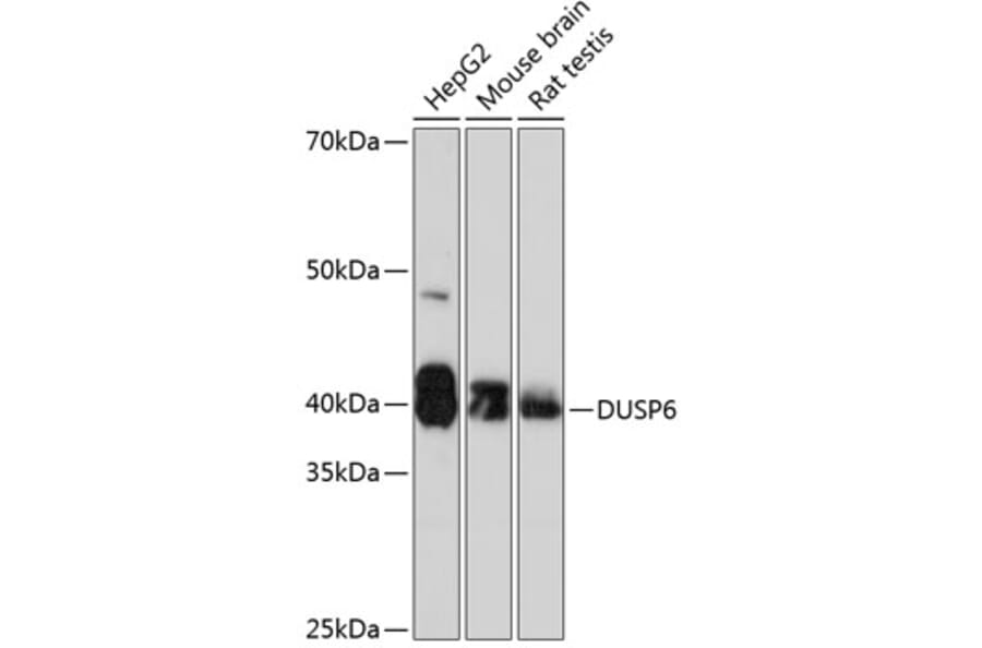 Western Blot - Anti-DUSP6 Antibody [ARC0237] (A305412) - Antibodies.com